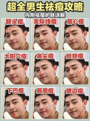 男孩怎么去痘（男生长痘痘怎么消除）