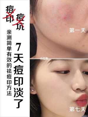 怎么去去痘印（怎么样去痘印）