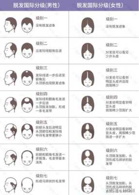 怎么判断脱发的类型（掉头发应该怎么办）
