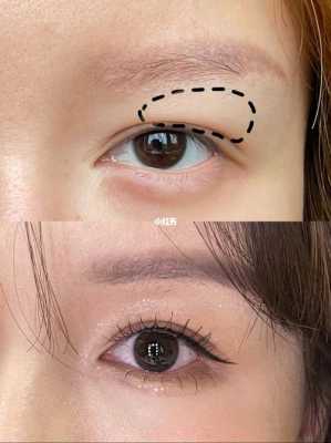 眼皮浮肿怎么画眼影（眼皮浮肿怎么画眼影图片）