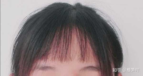 刘海拉焦了有什么补救（刘海拉焦了怎么办）