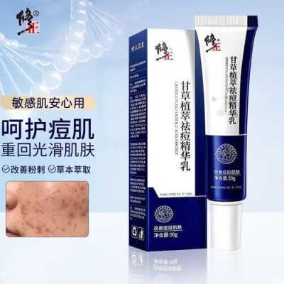 祛痘最有效的方法,用什么方法可以去痘痘和痘印