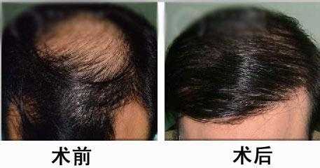 种头发是什么意思（你知道头发的截面是什么形状）