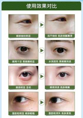 眼角干纹怎么去除（眼部有细纹干纹如何改善）