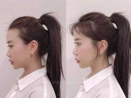 秃鬓角的人适合什么发型,秃鬓角女适合什么发型图片
