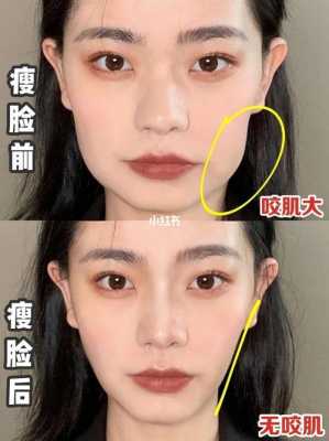 方脸的人怎么瘦脸（方脸怎么改善咬肌）