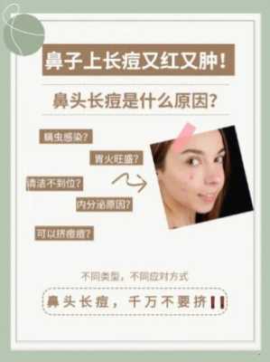 鼻头长痤疮怎么办（鼻头的痘痘怎么去除）