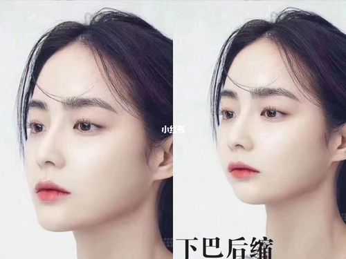 下颌骨什么样好看，决定颜值吗,什么下巴最好看图片女