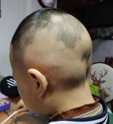 头发少怎么才能变多（一岁半宝宝头发少是什么原因，要给宝宝补点什么可以让头发变多）