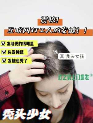 头发稀少怎么补救,头发太稀少怎样增发