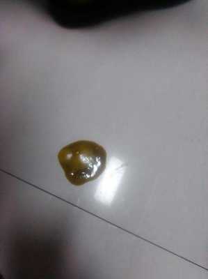 宝宝1岁了拉灰色的大便是怎么回事,奶水灰色的怎么回事啊