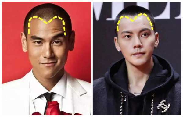 发际线不齐留什么发型（发际线齐是好还是不好）