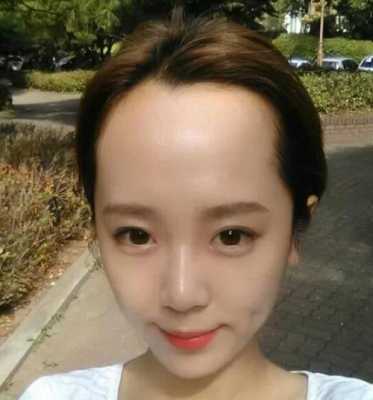 发际线不齐留什么发型（发际线齐是好还是不好）
