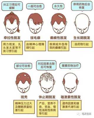 怎么预防遗传性脱发（怎么预防遗传性脱发）