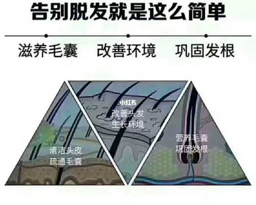 怎么预防遗传性脱发（怎么预防遗传性脱发）
