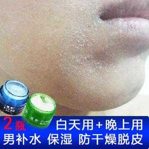 干皮秋冬起皮怎么办,男士冬季皮肤干燥脱皮咋办