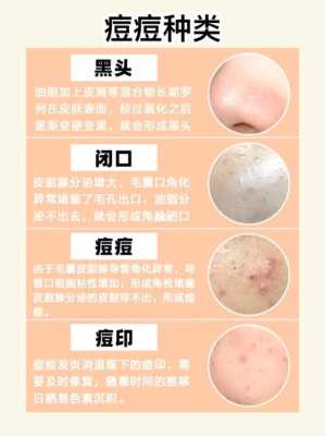 满脸黑头粉刺怎么办（黑头粉刺怎么解决）