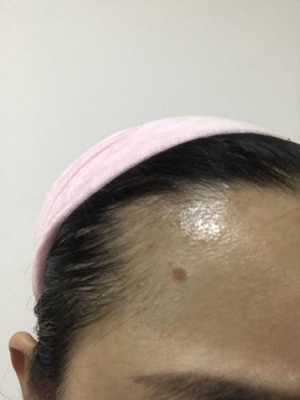 额头长头发怎么回事（额头中间有个尖尖长出一点头发代表什么意思）