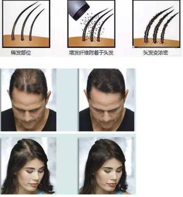 怎样使稀疏头发变浓密,怎么样头发才能浓密一点