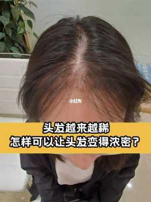 怎样使稀疏头发变浓密,怎么样头发才能浓密一点