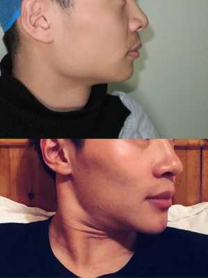 男生下巴几厘米好看,男人什么样的下巴好看图片