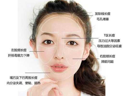 脸上额头长痘痘怎么调理（脸上额头长痘怎么办）