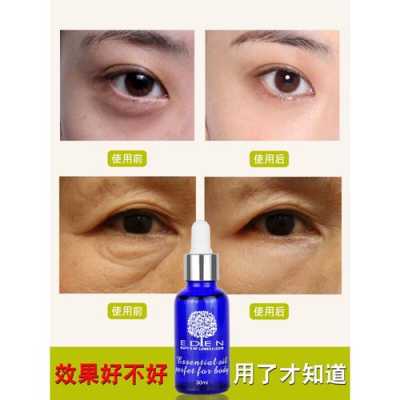 眼睛有黑眼圈怎么去除（怎样快速有效的去除黑眼圈）