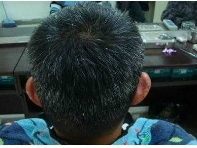 什么人种天生头发白,头发长白白的是什么东西