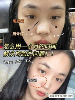 脸颊毛孔大是什么原因（脸颊毛孔大是什么原因）