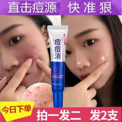用什么东西可以去痘痘（用什么东西可以去痘痘和痘印）