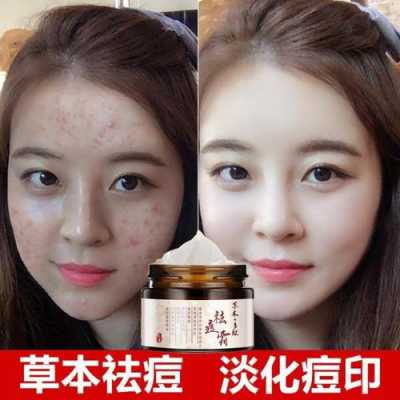 用什么东西可以去痘痘（用什么东西可以去痘痘和痘印）