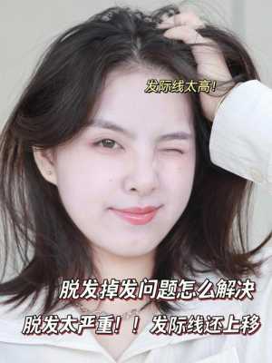 额头前头发向上长咋解决,前面头发翘起来怎么办女生