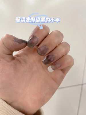 染头发把手染了怎么办（染头发把手染了怎么办小妙招）