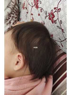 小孩前额头发少怎么办（小孩前额头发少怎么办呢）