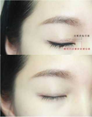 超级单眼皮怎么贴双眼皮贴,单眼皮怎么粘双眼皮的