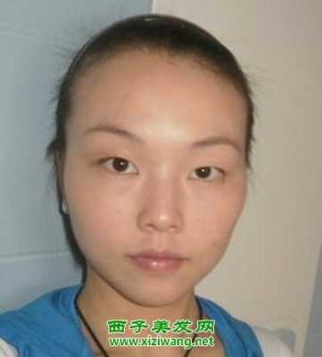 额头两侧头发少怎么办（额头两边头发越来越少）