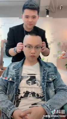 发际线两侧高怎么办（发际线高两边秃适合什么发型）