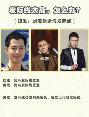 左右两边发际线太高了怎么挽救,男生额头两边发际线高怎么办