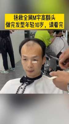 左右两边发际线太高了怎么挽救,男生额头两边发际线高怎么办