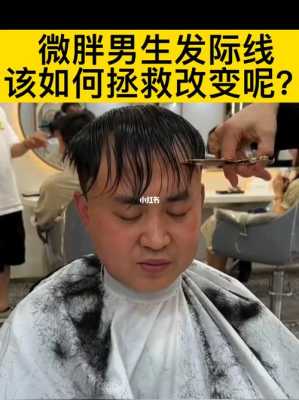 左右两边发际线太高了怎么挽救,男生额头两边发际线高怎么办