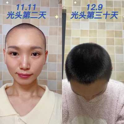 我是个女生我的头发剃光了怎麼可以让头发长的快,头发剪了吃什么长的快一点