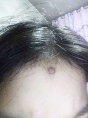 男生脸上怎么长肉（怎样可以使脸上长肉）