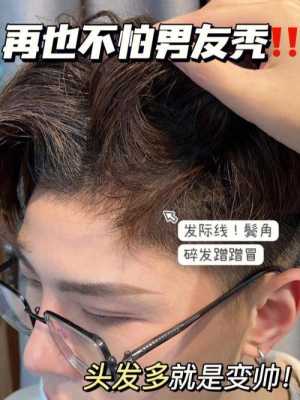 鬓角脱发怎么治疗（请问大夫秃鬓角怎么治）