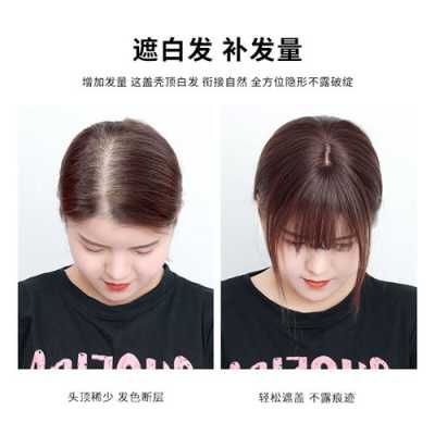 怎么样补头发（补头发多少钱）