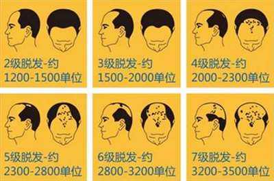 毛发脱落是什么原因引起的（全身毛发脱落是什么原因引起的）