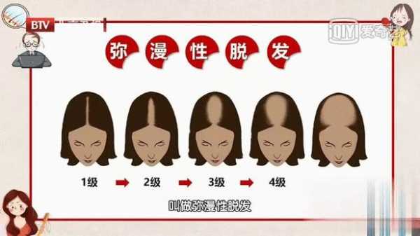 掉头发是什么原因啊（掉头发是什么原因啊女性）
