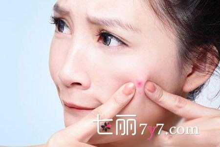 脸上长痘痘怎么消除,脸上起粉刺怎么去掉小妙招