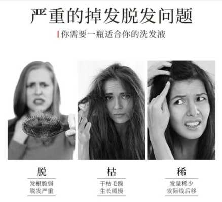 冬季掉头发是什么原因（冬季掉头发是什么原因引起的）