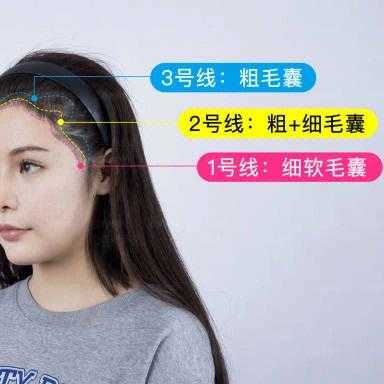 发髻线怎么弄（增加发际线的方法）