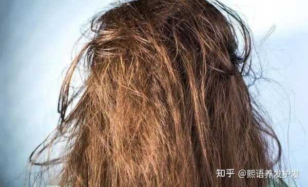 为什么头发洗多了会掉,为什么洗头时会掉很多头发?